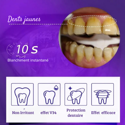 Dentifrice Blanchissant V34 effet dent blanche