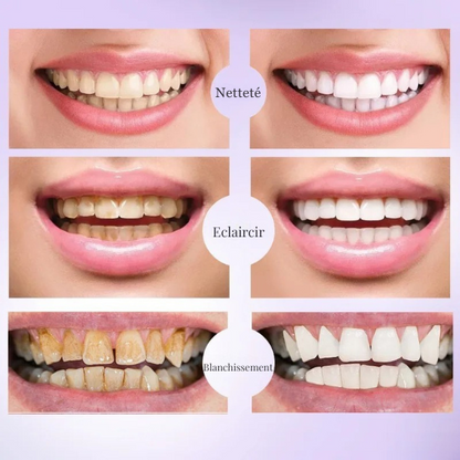 Dentifrice Blanchissant V34 effet dent blanche